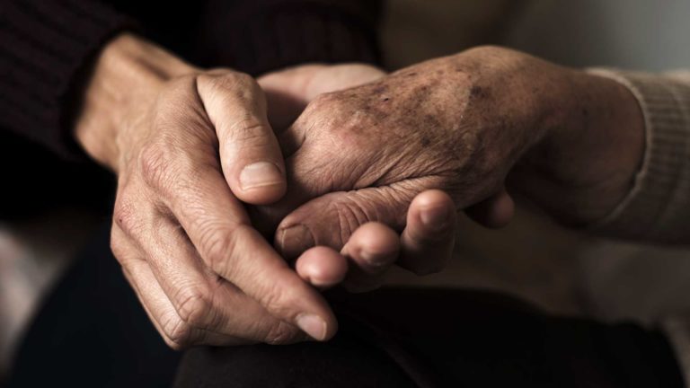 Alzheimers