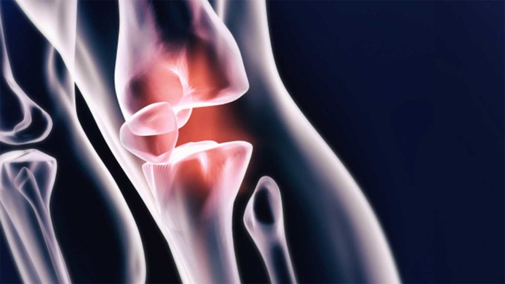 Sharecare to Host Twitter Chat on Injury Prevention and Orthopedics